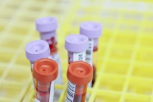 Clinical trial blood samples